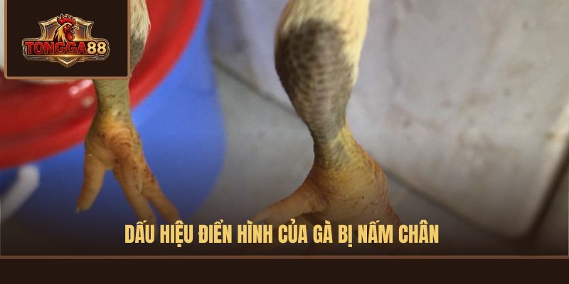 gà bị nấm chân